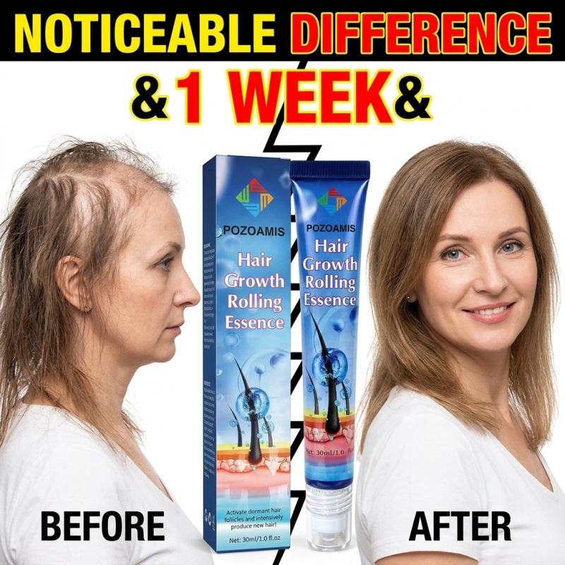 Hair Care Essence - เซรั่มบำรุงหนังศีรษะและเส้นผมแบบลูกกลิ้งพกพาสะดวก บำรุงหนังศีรษะ เสริมความแข็งแรงให้เส้นผมที่เปราะบาง ปรับปรุงลักษณะโดยรวมของเส้นผม สะดวกสำหรับการดูแลความงามของเส้นผมที่บ้านและระหว่างเดินทาง