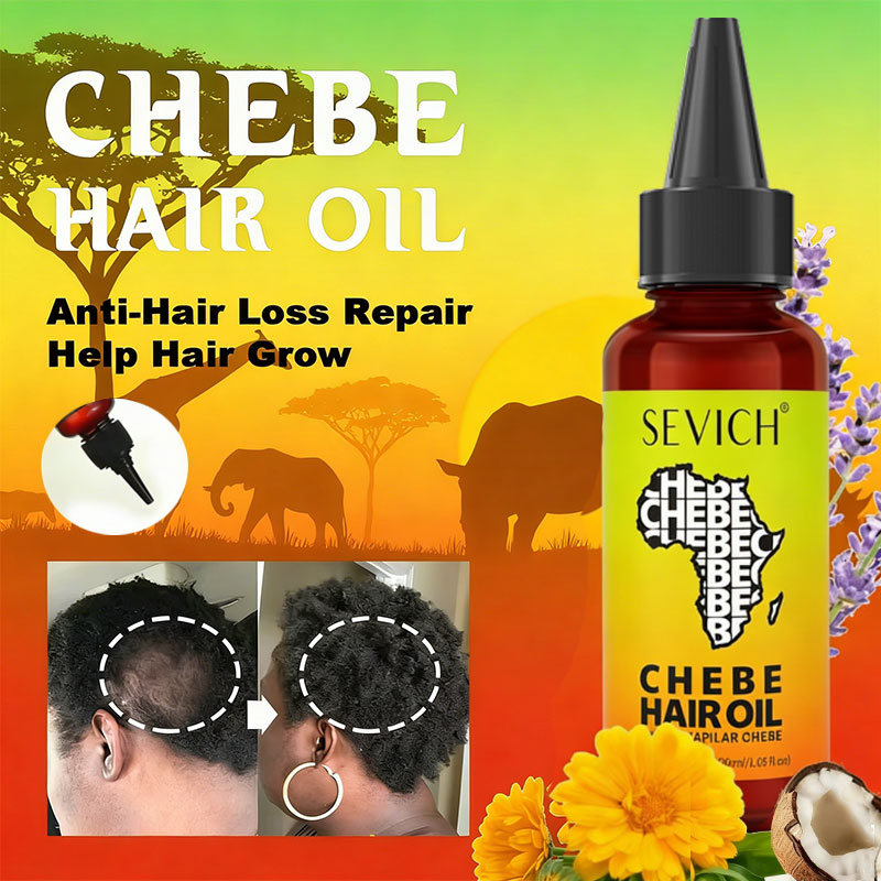 Hair Care Elseve - น้ำมันเชเบะเร่งผมยาว น้ำมันเชเบะจากแอฟริกา สำหรับผมร่วงจากภาวะแทรกชั่น อลโอเปเซีย บำรุงและซ่อมแซมเส้นผมที่เสียหาย ป้องกันผมร่วง
