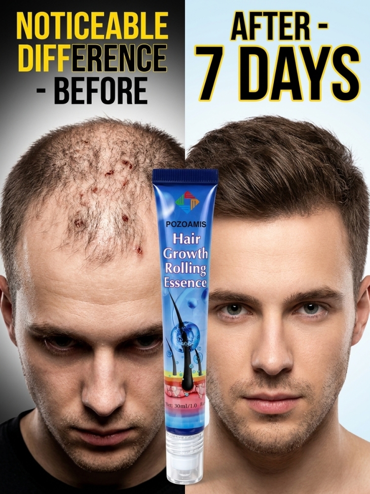 Hair Care Essence - โรลเลอร์บอล เอสเซนส์บำรุงเส้นผมและหนังศีรษะ, บำรุงหนังศีรษะและรากผม, ช่วยปรับปรุงลักษณะผมที่ดูบาง, ดีไซน์ลูกกลิ้งนวดที่ใช้งานสะดวก, เนื้อเซรั่มบางเบาสำหรับการดูแลความงามของเส้นผมและหนังศีรษะในชีวิตประจำวัน
