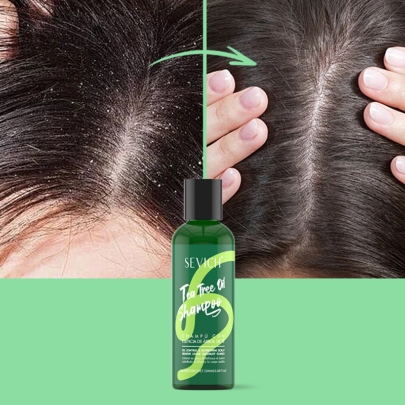 Tea Tree Essence แชมพูครีมนวดผ - Hair Care Essence บทวิจารณ์และราคา